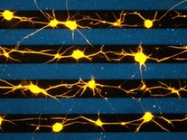 Neuer Wegweiser f�r wandernde Nervenzellen entdeckt