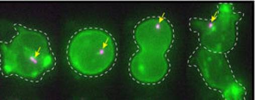 Primäre Zilie wird vererbt