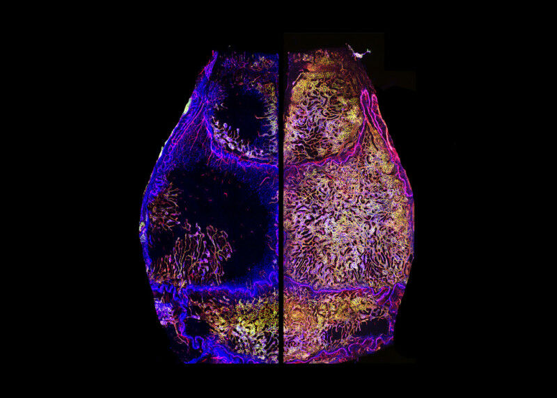 Skull bone marrow vessels (red) of a young adult (left) and a geriatric (right)