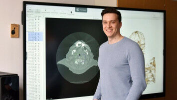 Verengungen der Halsschlagader sichtbar machen