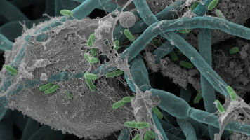 Warum Vitamin E-Wirkung bisher oft reine Gl�ckssache ist