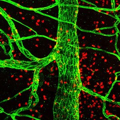 Bei einer Entzündungsreaktion wandern weiße Blutkörperchen (Leuko