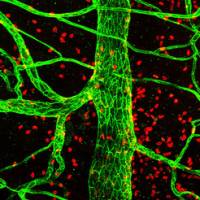 Wie der Körper Entzündungen im Zaum hält