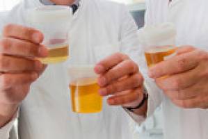 Wie halten die Nieren unser Blut sauber?