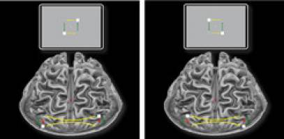 Zwei Gehirnh�lften, eine Wahrnehmung